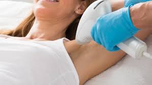 Laser Hair Removal (Painless)